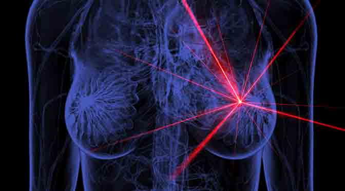 Investigadores del Conicet desarrollan mamografías sin rayos